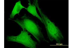 Immunofluorescence of purified MaxPab antibody to DBC1 on HeLa cell. (DBC1 抗体  (AA 1-320))