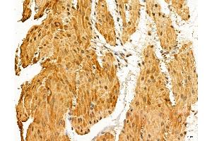 ABIN7094334 and ABIN7098381 at 1/100 staining Rat stomach tissue by IHC-P. (LARS2 抗体  (Internal Region))