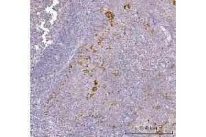IHC analysis of AGPS using anti-AGPS antibody (ABIN7600146).