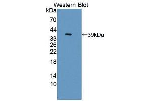 Western blot analysis of the recombinant protein. (PLSCR1 抗体  (AA 1-318))