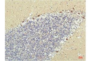 Immunohistochemical analysis of paraffin-embedded Human Brain Tissue using PPAR Delta Mouse mAb diluted at 1:200. (PPARD 抗体)