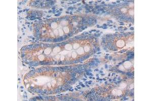 Immunohistochemistry (IHC) image for anti-Tumor Necrosis Factor Receptor Superfamily, Member 25 (TNFRSF25) (AA 38-167) antibody (ABIN5014482)