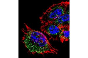 Fluorescent confocal image of A431 cell stained with MRPL28 Antibody (N-term) (ABIN1539254 and ABIN2838173). (MRPL28 抗体  (N-Term))