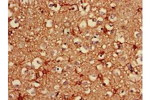 Immunohistochemistry of paraffin-embedded human brain tissue using ABIN7153847 at dilution of 1:100 (GFAP 抗体  (AA 292-432))