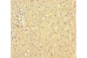 Immunohistochemistry of paraffin-embedded human liver tissue using ABIN7149462 at dilution of 1:100 (GLCE 抗体  (AA 29-617))