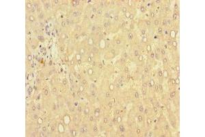 Immunohistochemistry of paraffin-embedded human liver tissue using ABIN7149462 at dilution of 1:100