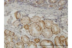 Immunoperoxidase of monoclonal antibody to TLN1 on formalin-fixed paraffin-embedded human small Intestine. (TLN1 抗体  (AA 1052-1149))