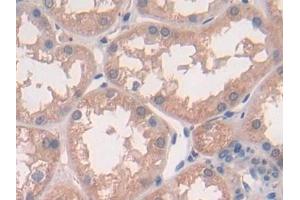 Detection of IL10 in Human Kidney Tissue using Polyclonal Antibody to Interleukin 10 (IL10) (IL-10 抗体  (AA 19-178))