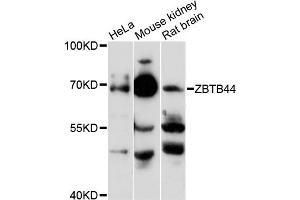 Western blot analysis of extracts of various cell lines, using ZBTB44 antibody (ABIN6291829) at 1:3000 dilution. (ZBTB44 抗体)