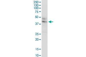 CTNS MaxPab rabbit polyclonal antibody. (CTNS 抗体  (AA 1-400))