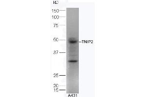 Human A431 lysates probed with Rabbit Anti-TNIP2 Polyclonal Antibody, Unconjugated  at 1:5000 for 90 min at 37˚C. (TNIP2 抗体  (AA 85-180))