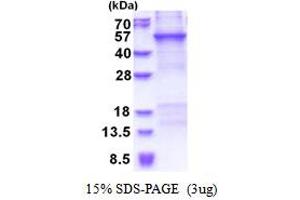 SDS-PAGE (SDS) image for Cartilage Associated Protein (CRTAP) (AA 27-401) protein (His tag) (ABIN6387378) (CRTAP Protein (AA 27-401) (His tag))