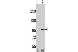 Western blot analysis of DDR1 antibody and 293 cell lysate (2 ug/lane) either nontransfected (Lane 1) or transiently transfected with the DDR1 gene (2).
