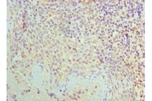 Immunohistochemistry of paraffin-embedded human tonsil tissue using ABIN7170857 at dilution of 1:100 (SMC1A 抗体  (AA 1-130))