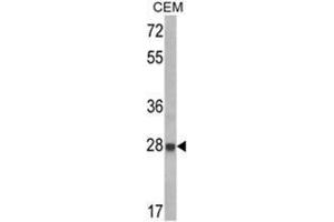 Western blot analysis of IGFBP6 Antibody (C-term) in CEM cell line lysates (35ug/lane).
