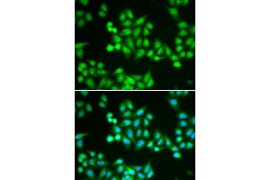 Immunofluorescence (IF) image for anti-Chromodomain Helicase DNA Binding Protein 2 (CHD2) antibody (ABIN1980262) (CHD2 抗体)