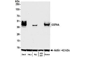 Western Blotting (WB) image for anti-B-cell antigen receptor complex-associated protein alpha chain (CD79A) (AA 176-226) antibody (ABIN7454005) (Recombinant CD79a 抗体  (AA 176-226))