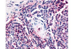 Anti-ATRN / Attractin antibody IHC of human spleen. (Attractin 抗体  (Internal Region))