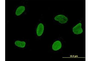 Immunofluorescence of monoclonal antibody to C15orf15 on HeLa cell. (RSL24D1 抗体  (AA 1-150))