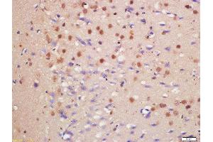 Formalin-fixed and paraffin embedded rat brain labeled with Anti-HDAC3/HD3 Polyclonal Antibody, Unconjugated  at 1:200 followed by conjugation to the secondary antibody and DAB staining (HDAC3 抗体  (AA 31-130))