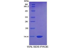 SDS-PAGE of Protein Standard from the Kit (Highly purified E. (CTGF CLIA Kit)