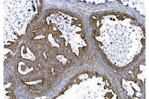 IHC analysis of TJP2/ZO2 using anti-TJP2/ZO2 antibody (ABIN7602800).