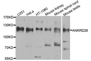 Western blot analysis of extracts of various cell lines, using ANKRD28 antibody. (ANKRD28 抗体  (AA 1-300))