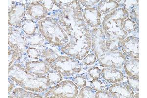Immunohistochemistry of paraffin-embedded rat kidney using SNAI1 antibody. (SNAIL 抗体  (AA 1-264))