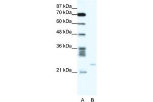 Western Blotting (WB) image for anti-BCL2-Related Protein A1 (BCL2A1) antibody (ABIN2463721) (BCL2A1 抗体)