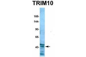 Western Blotting (WB) image for anti-Tripartite Motif Containing 10 (TRIM10) (C-Term) antibody (ABIN2775785)