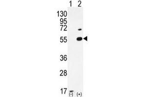 Western blot analysis of PRMT2 antibody and 293 cell lysate either nontransfected (Lane 1) or transiently transfected (2) with the PRMT2 gene. (PRMT2 抗体  (AA 22-53))