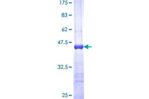 MFAP2 Protein (AA 76-158) (GST tag)