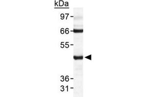 Western blot analysis of TARDBP in HeLa whole cell extract with TARDBP polyclonal antibody . (TARDBP 抗体  (AA 350-414))