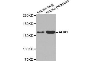 Western blot analysis of extracts of various cell lines, using AOX1 antibody. (AOX1 抗体  (AA 340-590))