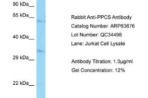Western Blotting (WB) image for anti-Phosphopantothenoylcysteine Synthetase (PPCS) (N-Term) antibody (ABIN2789587) (PPCS 抗体  (N-Term))