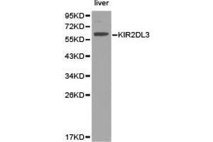 Western Blotting (WB) image for anti-Killer Cell Immunoglobulin-Like Receptor, Two Domains, Long Cytoplasmic Tail, 3 (KIR2DL3) antibody (ABIN1873416) (KIR2DL3 抗体)