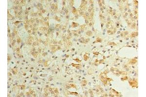 Immunohistochemistry (IHC) image for anti-Zinc Finger, DHHC-Type Containing 3 (ZDHHC3) (AA 94-171) antibody (ABIN7162550)