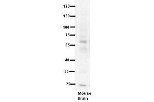 WB Suggested Anti-PDE9A Antibody Titration:  5% Milk  ELISA Titer:  dilution: 1:500  Positive Control:  Mouse Brain lysate (PDE9A 抗体  (N-Term))