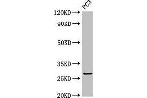 Western Blot Positive WB detected in: PC-3 whole cell lysate All lanes: IL34 antibody at 4 μg/mL Secondary Goat polyclonal to rabbit IgG at 1/50000 dilution Predicted band size: 28 kDa Observed band size: 28 kDa (IL-34 抗体  (AA 191-240))