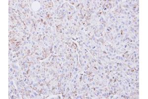 IHC-P Image Immunohistochemical analysis of paraffin-embedded U87 xenograft, using COX2, antibody at 1:100 dilution. (PTGS2 抗体  (C-Term))