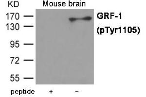 Western blot analysis of extracts from Mouse brain tissue using GRF-1 (Phospho-Tyr1105) Antibody. (GRLF1 抗体  (pTyr1105))