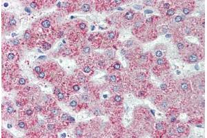 Liver, Human: Formalin-Fixed, Paraffin-Embedded (FFPE) (GPR146 抗体  (Internal Region))
