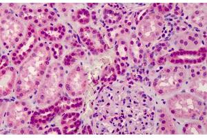 Human Kidney: Formalin-Fixed, Paraffin-Embedded (FFPE) (GRTP1 抗体  (Internal Region))