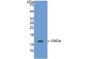 Detection of Recombinant HEXb, Mouse using Polyclonal Antibody to Hexosaminidase B Beta (HEXb) (HEXB 抗体  (AA 101-217))