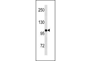 INSR Antibody (N-term) (ABIN1881461 and ABIN2843249) western blot analysis in MDA-M cell line lysates (35 μg/lane). (Insulin Receptor 抗体  (N-Term))
