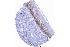 In squamous epithelium occludin positivity is regularly seen but staining is reduced or absent in basal and superficial cell layers scaled (Occludin 抗体  (AA 282-415))