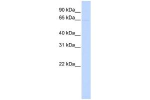 PIGZ antibody used at 1 ug/ml to detect target protein. (IGHV5-2 抗体  (N-Term))