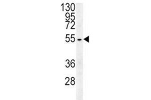 Beta III Tubulin antibody western blot analysis in HepG2 lysate (TUBB3 抗体  (AA 36-63))