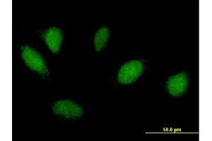 Immunofluorescence of purified MaxPab antibody to MSX1 on HeLa cell.
