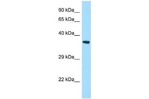 WB Suggested Anti-STARD7 Antibody Titration: 1. (STARD7 抗体  (N-Term))